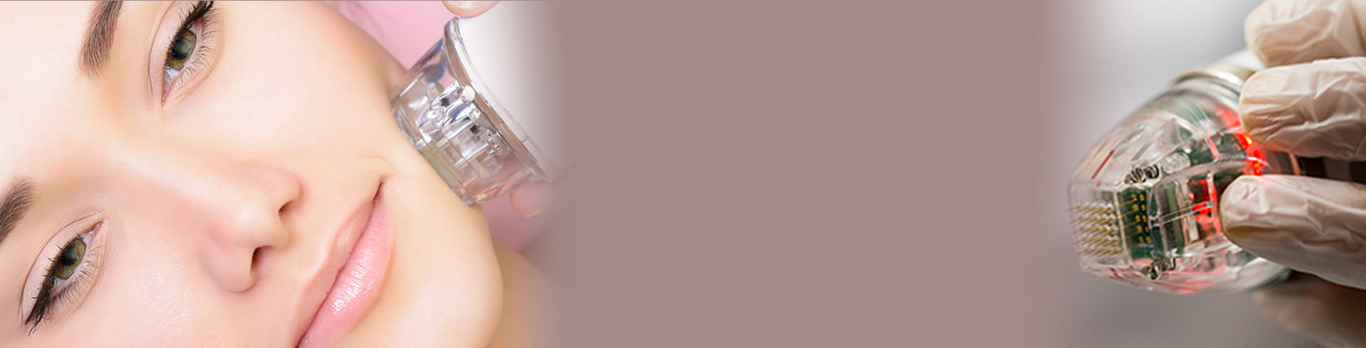 Altın İğne Cilt Bakımı