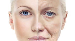Anti Aging