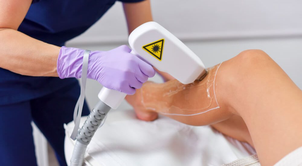 Buz Lazer Epilasyon Pendik