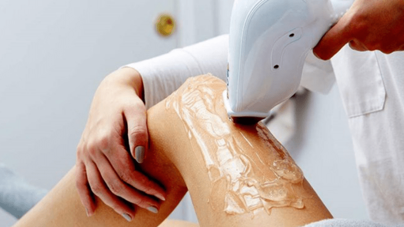 Diode Buz Lazer Epilasyon