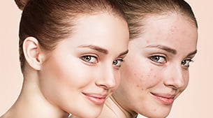 Leke Bakımı Pendik