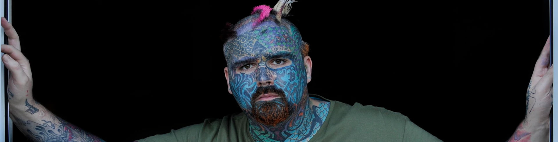 Pico Lazerle Dövme Silme