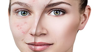 Profesyonel Leke Bakımı