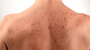 Sırt Bakımı Kurtköy