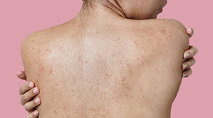 Sırt Bakımı Pendik