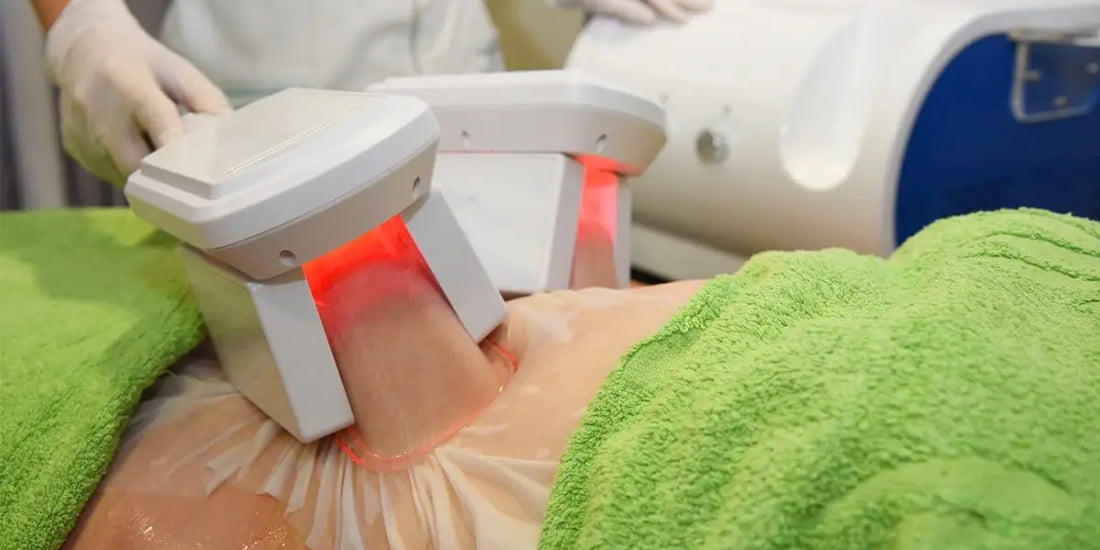 Soğuk Lipoliz Bölgesel İncelme