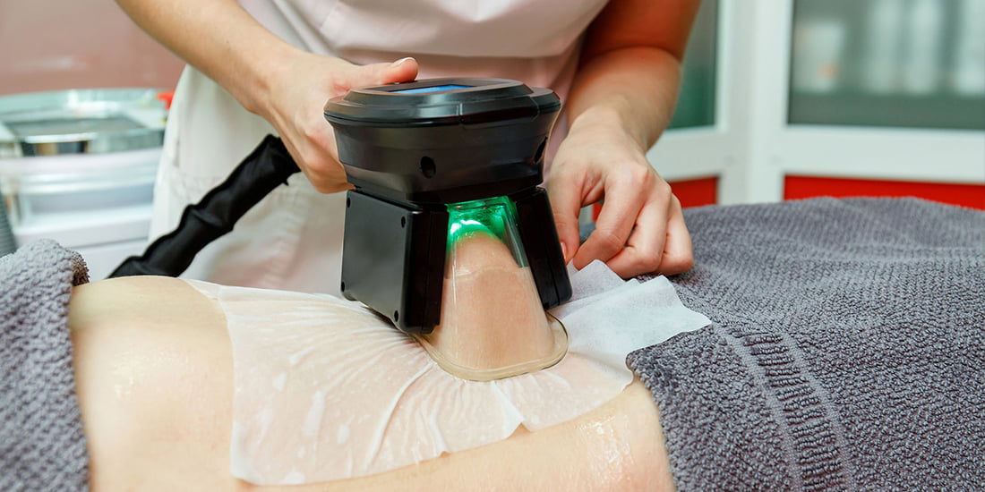 Soğuk Lipoliz Bölgesel Sıkılaşma