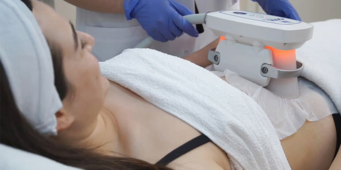 Soğuk Lipoliz Bölgesel Zayıflama