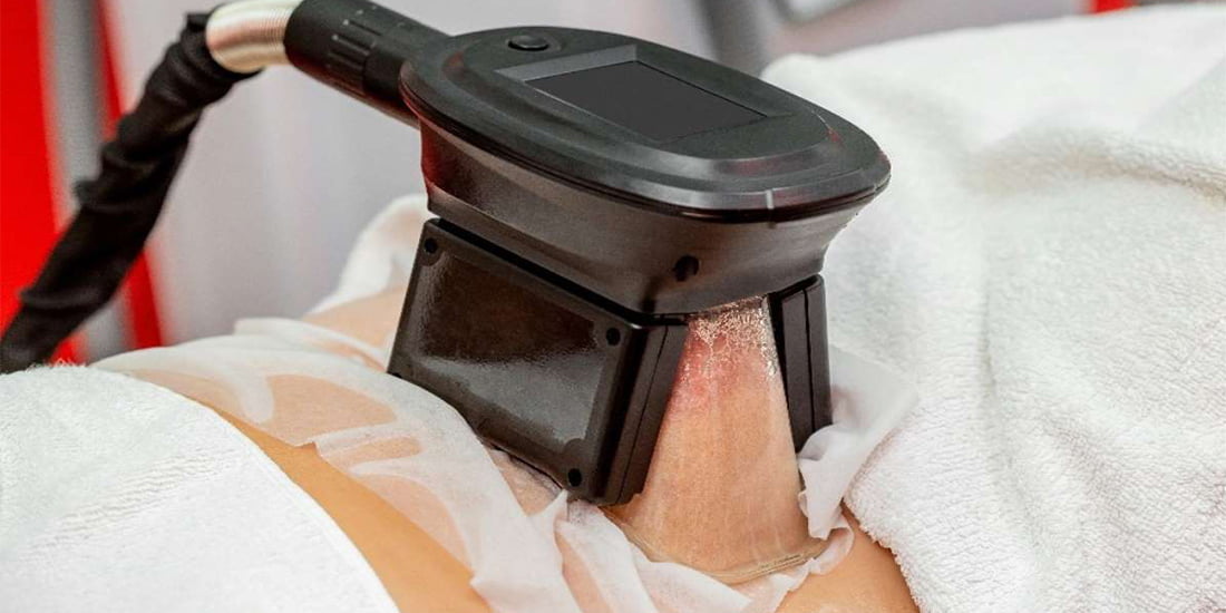 Soğuk Lipoliz Pendik