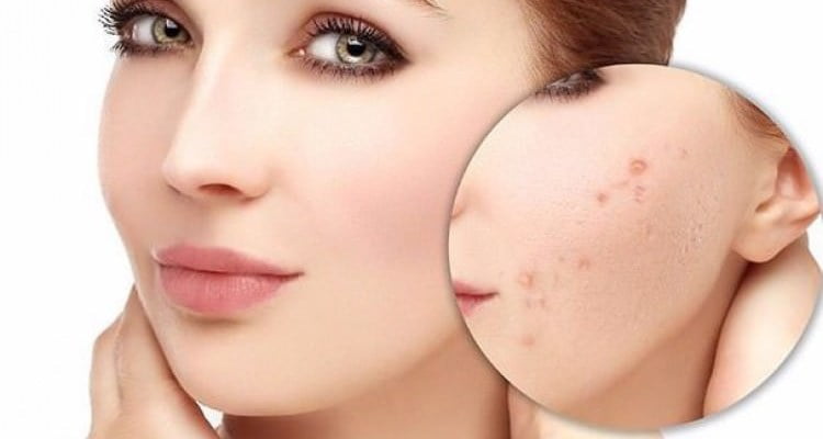 Dermapen Cilt Bakımı