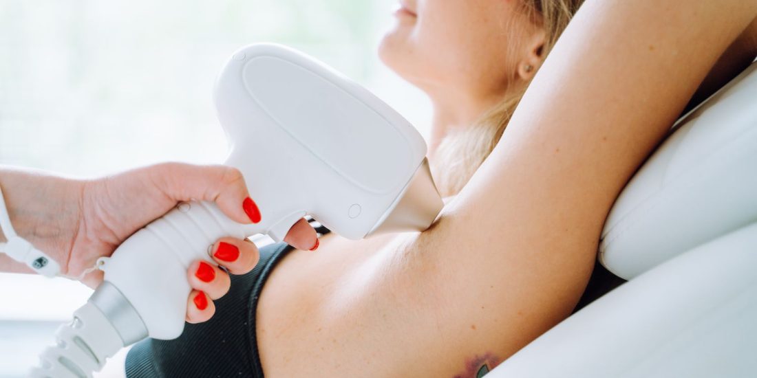 Kadın Lazer Epilasyon