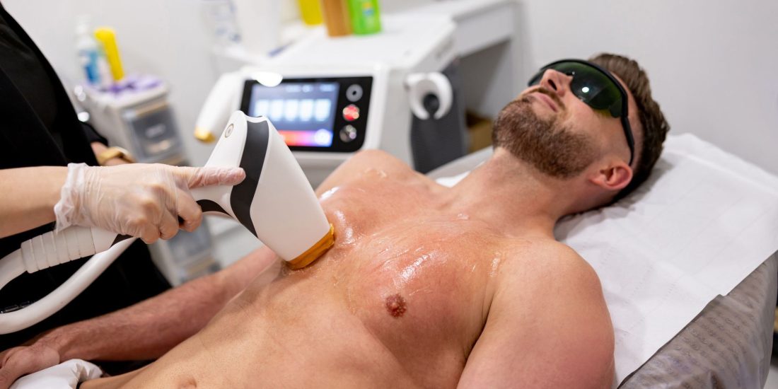 Pendik Lazer Epilasyon Erkek