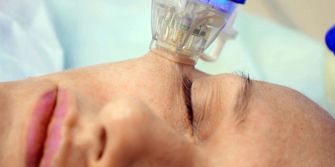 Altın İğne Cilt Bakımı