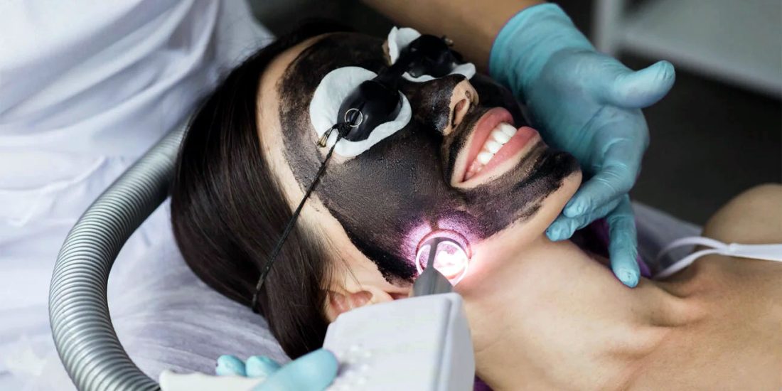 Karbon Peeling Cilt Bakımı